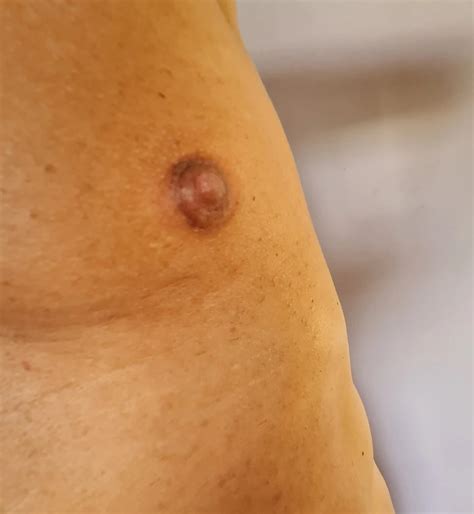 NIPPLES PUMPED ESSION Nude Pics XHamster