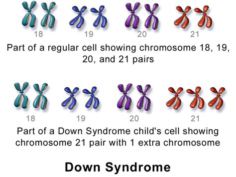 Disease vs. Syndrome