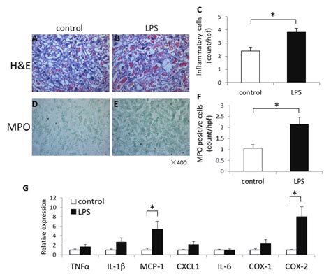 Intra Amniotic Injection Of Lps Caused Chronic Inflammation In Placenta