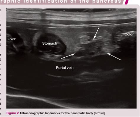 Figure From Feline Abdominal Ultrasonography Whats Normal Whats