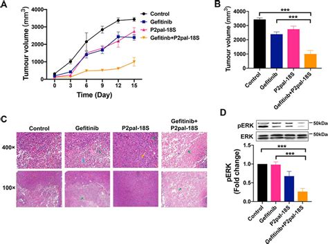 Frontiers Targeting PAR2 Overcomes Gefitinib Resistance In Non Small