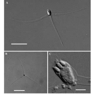 Line Drawings Of Mature Spores A Raabeia Type 1 New Type B