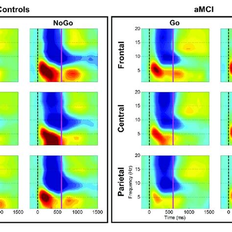 Group Comparison Of Spectrograms For Response Types Across Electrode Download Scientific