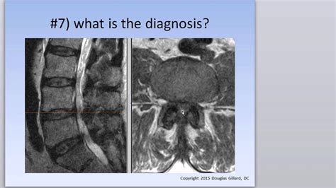 Differential Diagnosis Ii Lumbar Spine Disease Summer 2015 Edited