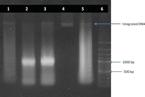 DNA fragmentation analysis by agarose gel electrophoresis. The DNA of... | Download Scientific ...