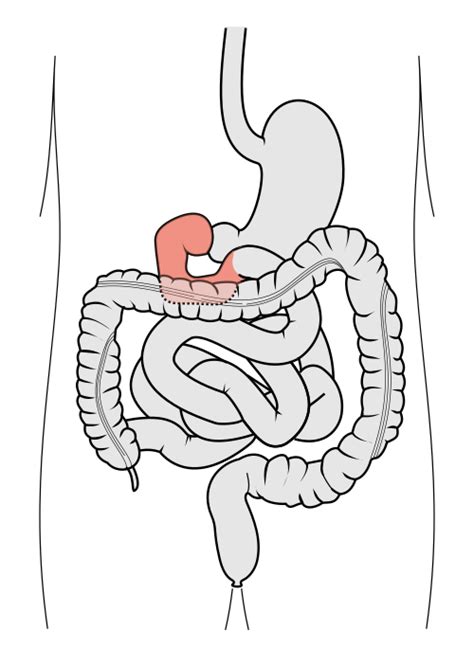 Duodenum Wikipedia