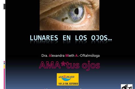 La doctora Alexandra Mieth en la sección ama tus ojos tema de hoy los