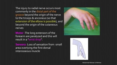 Upper Limb Nerve Injuries Ppt