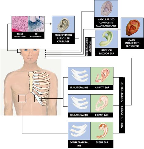 Auricular Reconstruction A Sociocultural Surgical And Scientific