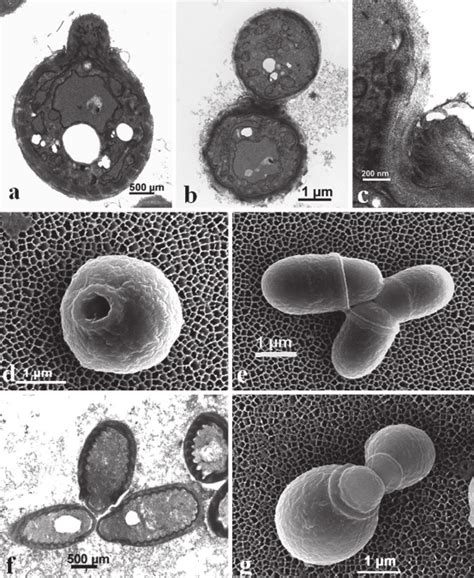 17 Malassezia Budding Process A D M Globosa A B Micrograph