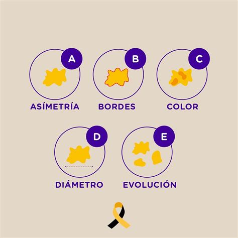 Día Mundial Del Melanoma Imágenes De Vida Y Salud