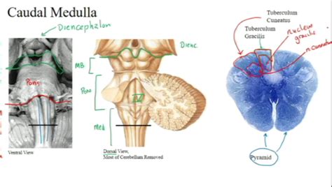 Brainstem Flashcards Quizlet