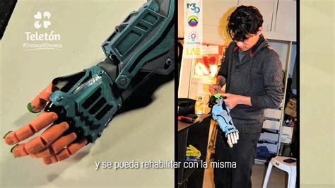 Prótesis de mano en impresión 3D YouTube