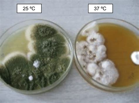 Microbe Notes Aspergillus Fumigatus On Sabouraud Dextrose 46 Off