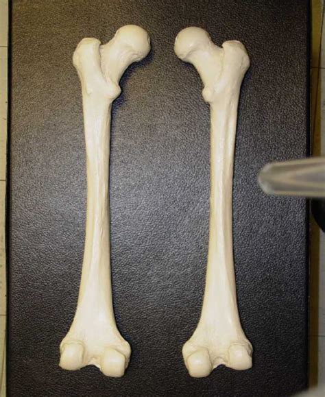 Right Femur Posterior View Diagram Quizlet