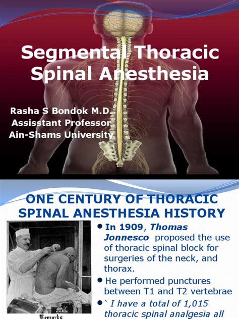 Segmental Thoracic Spinal Pdf Anesthesia Vertebral Column