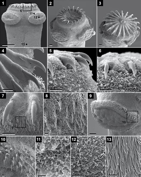 Vermaia Pseudotropii Verma Scanning Electron Photomicrographs