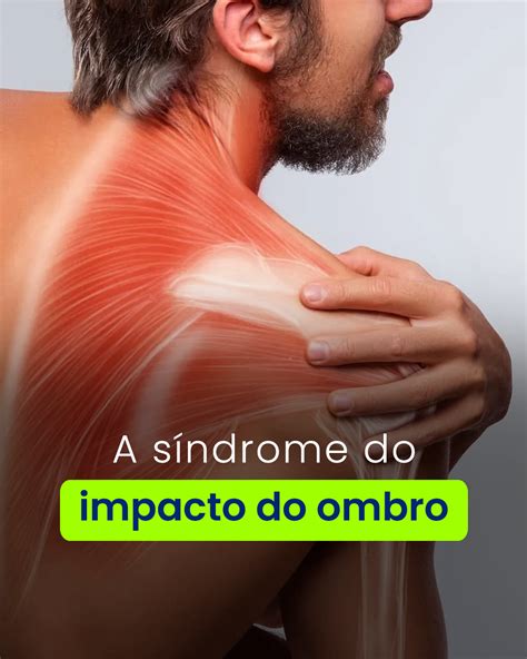 A S Ndrome Do Impacto Do Ombro Kinex Fisioterapia