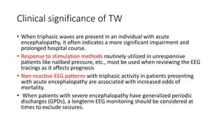 Triphasic waves in EEG | PPT