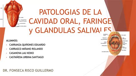 Patolog As De La Cavidad Oral Faringe Y Gl Ndulas Salivales Dr Fonseca