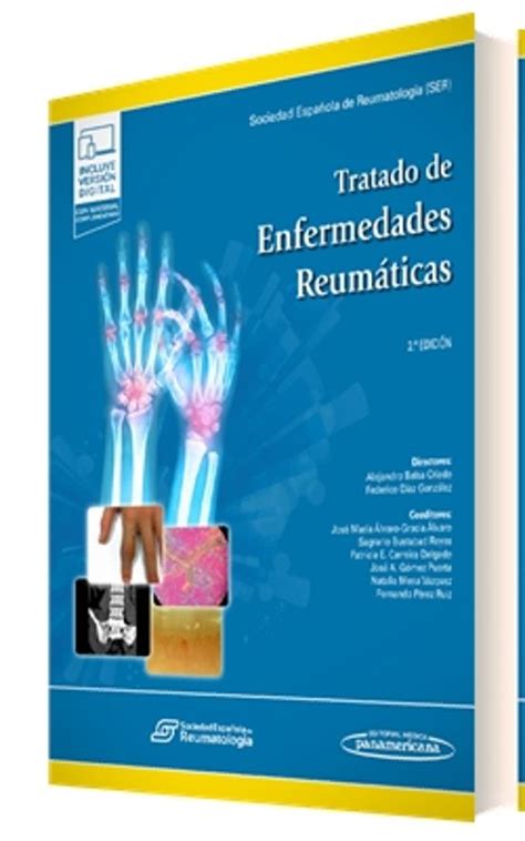 Tratado De Enfermedades Reumáticas Libro Del 2022 Escrito Por Vvaa Isbn 9788411060332 La