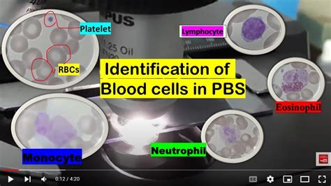 Blood Cells Identification Rbcs Wbcs Platelets Leishman Stain Of