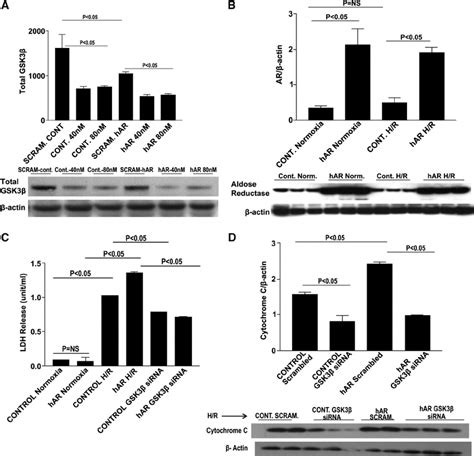 GSK3 Small Interfering RNA SiRNA Knock Down In HL 1 Cells Western