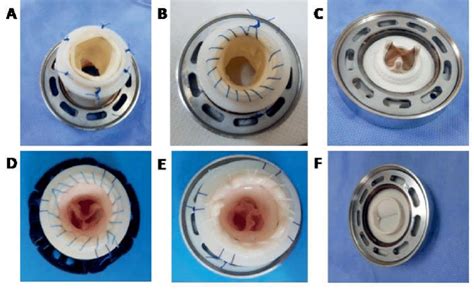 Tested Valvular Models A Decellularized Porcine Aortic Valve B