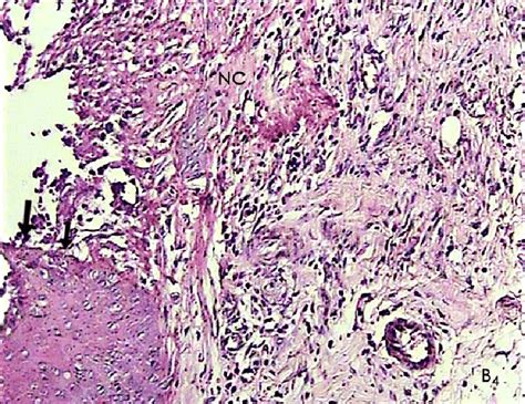 A Histological Photomicrograph Of Hematoxylin And Eosin Stained