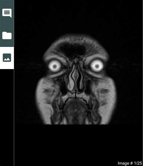 My MRI scan : r/oddlyterrifying