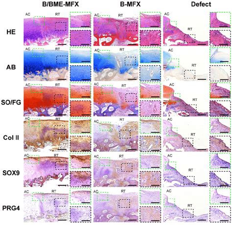 Histological Analyses On The Cartilage Repairs Between The Different Download Scientific