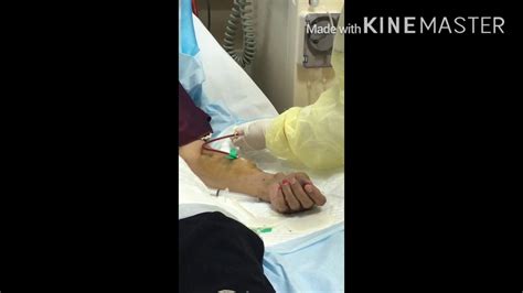 Hemodialysis Av Fistula Cannulation And Connection Youtube