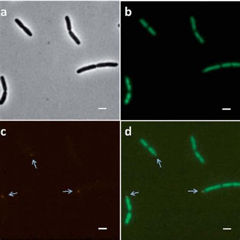 Fluorescence Microscopy Photos Of E Coli Mg Cells At Their Mid Log