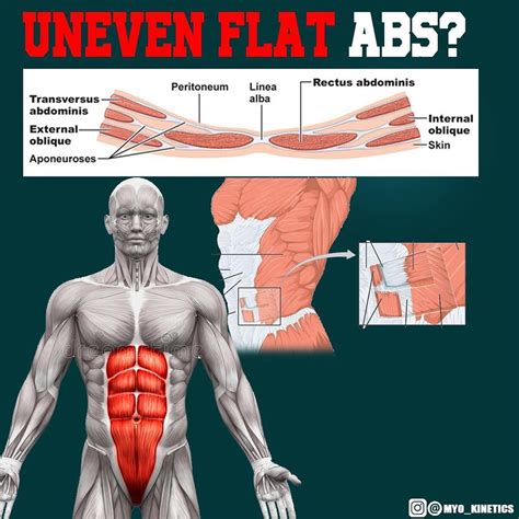 how to fix lopsided abs