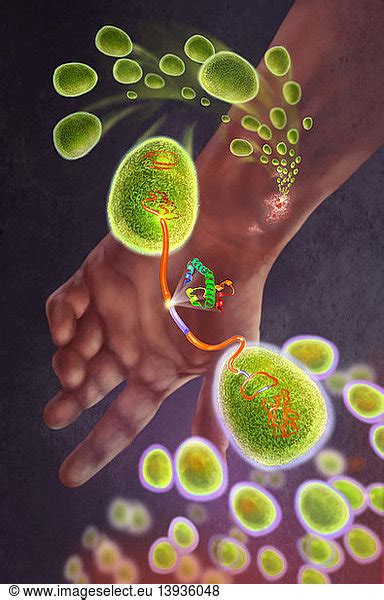 Staph Infection Becoming Mrsa Bacteria Staph Infection Becoming Mrsa Bacteriaworkaureus