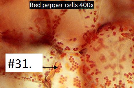 Carrot Chromoplast