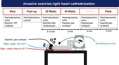 Hemodynamic Assessment In Heart Failure With Preserved Ejection