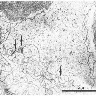 Low Power Micrograph Of A Rosette From A Human To Rat Epiretinal