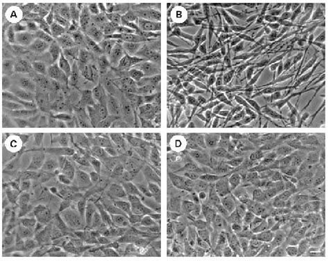 Morphological Alteration Of V Crk Expressing Fibroblasts Nih T Cells