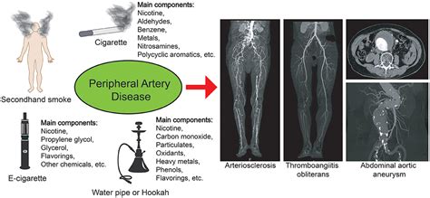 Frontiers Smoking And The Pathophysiology Of Peripheral Artery Disease