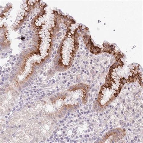 Anti Midn Antibody Produced In Rabbit