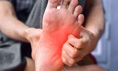 How To Treat Burning Sensation In Legs