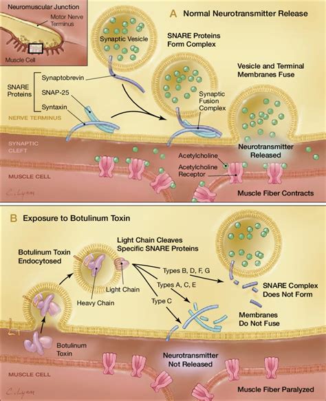 Mechanism of Action of Botulinum Toxin | Download Scientific Diagram