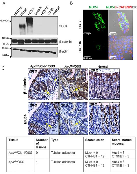 Increased Nuclear β Catenin Is Associated With Reduced Muc4 Expression Download Scientific