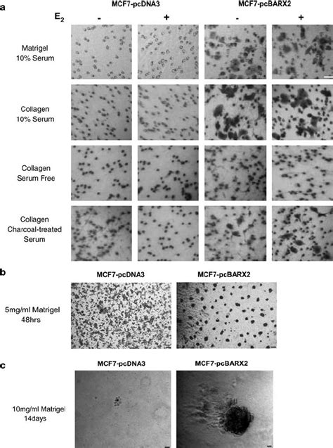 BARX2 Expression Induces Invasion Of MCF7 Cells In Matrigel And