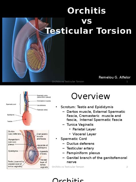 Orchitis Vs Testicular Torsion Urology Report Medical Specialties Genitourinary System Diseases