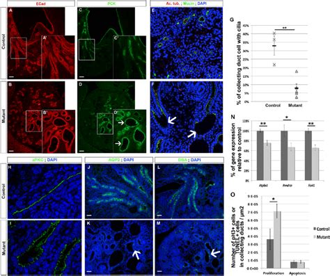 HNF1B Is Required For Collecting Duct Cell Differentiation A D