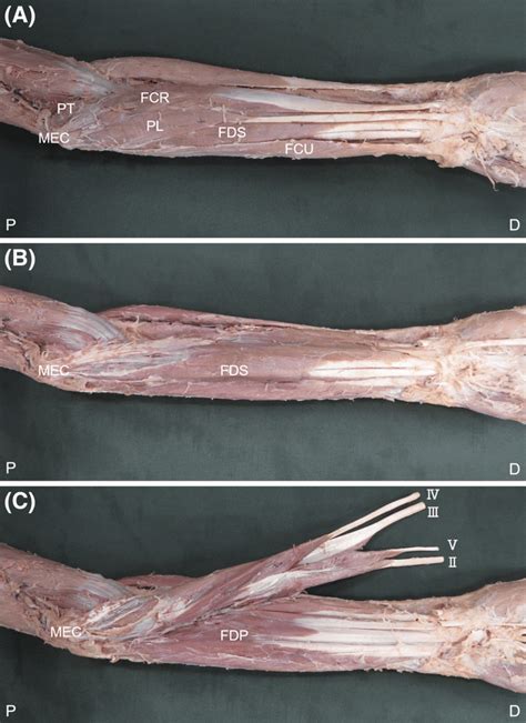 Forearm Flexor Anatomy