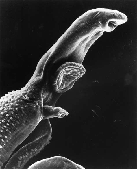 The Most Dangerous Human Parasites Ever Discovered