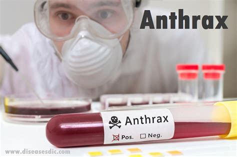 Anthrax - Causes, Dangers, Treatment, and Prevention